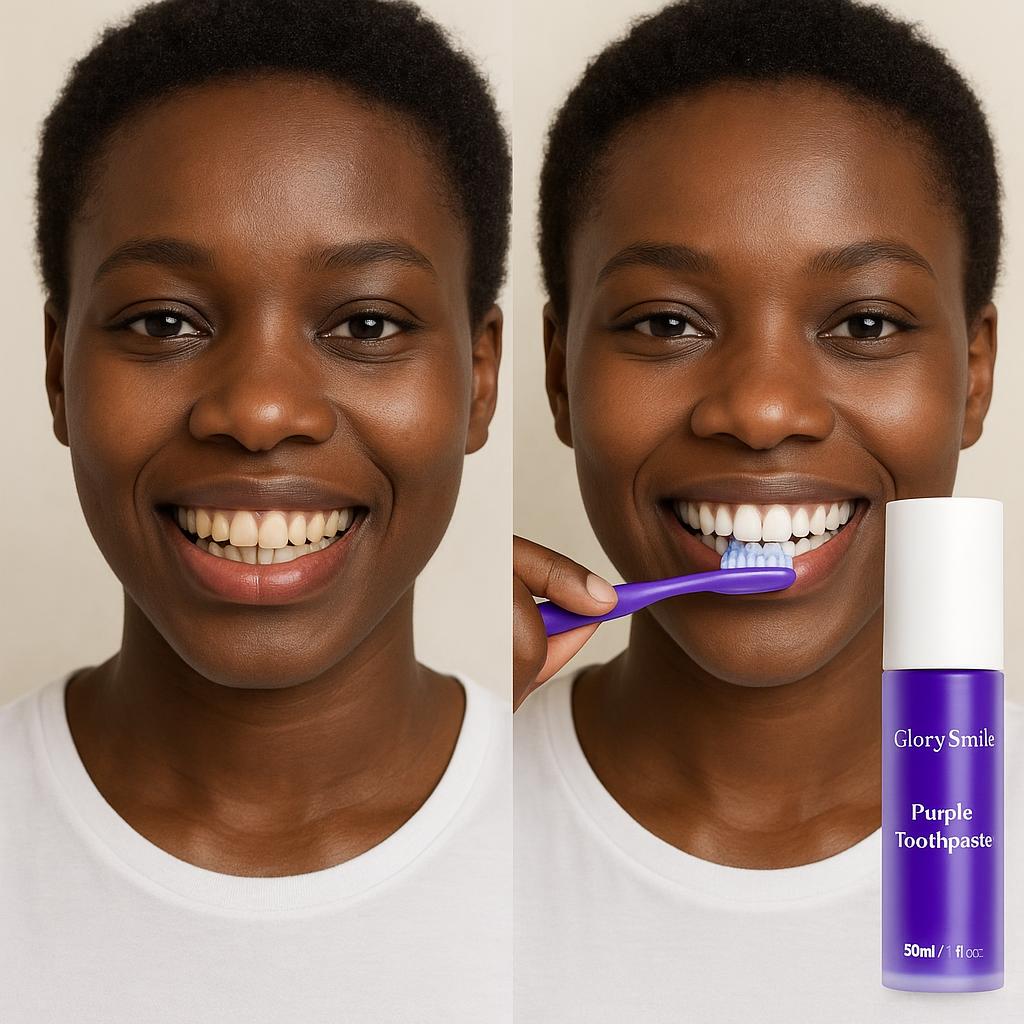 Dentifrice Violet V34 Éclaircissant - Blanchiment Dentaire Professionnel